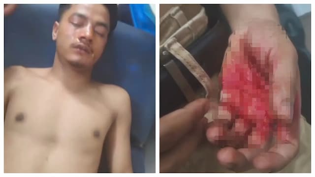 ফুলবাড়ীতে ছাত্রশক্তির সদস্য সচিবের উপর ছাত্রদল নেতাকর্মীদের অতর্কিত হামলা