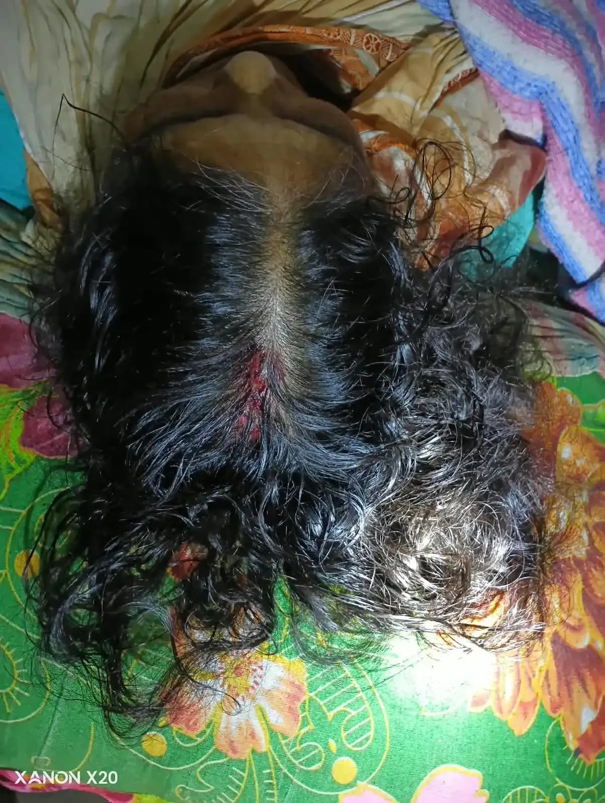 রুহিয়ায় পানির পাম্প চুরি করতে গিয়ে বৃদ্ধাকে পিটিয়ে হত্যা