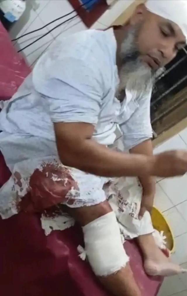 দৌলতপুরে পথরোধ করে হামলা, গ্রাম ডাক্তারসহ দুই ভাই গুরুতর আহত।